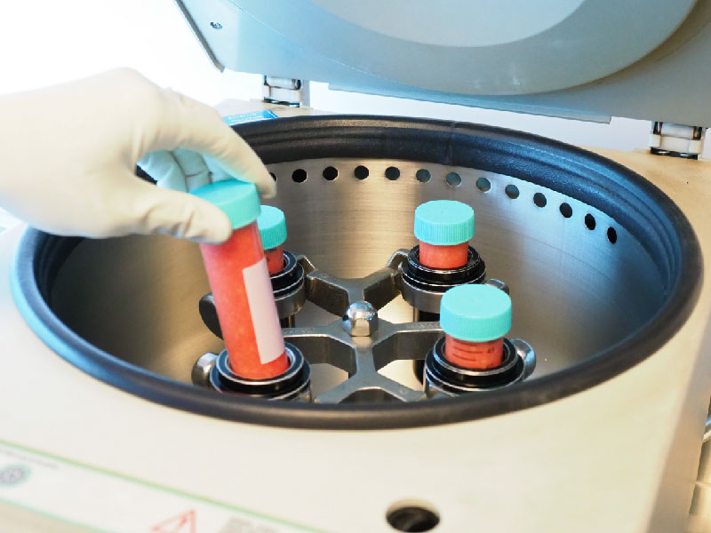 fat-transfer-buttock-2 fat-transfer-buttock-2