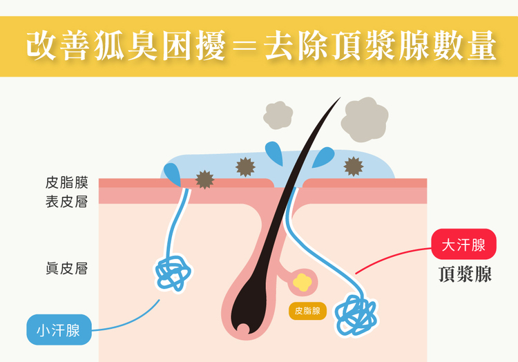 bromhidrosis bromhidrosis