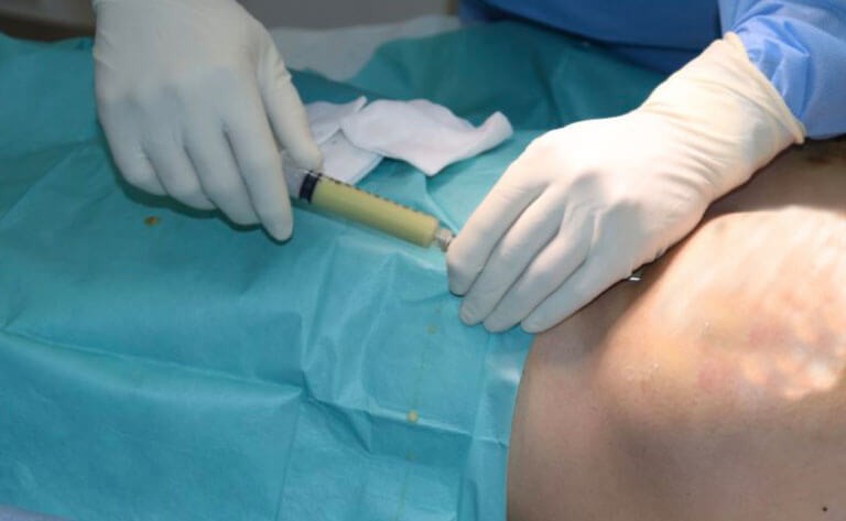 breast-augmentation-and-sepsis-4 breast-augmentation-and-sepsis-4