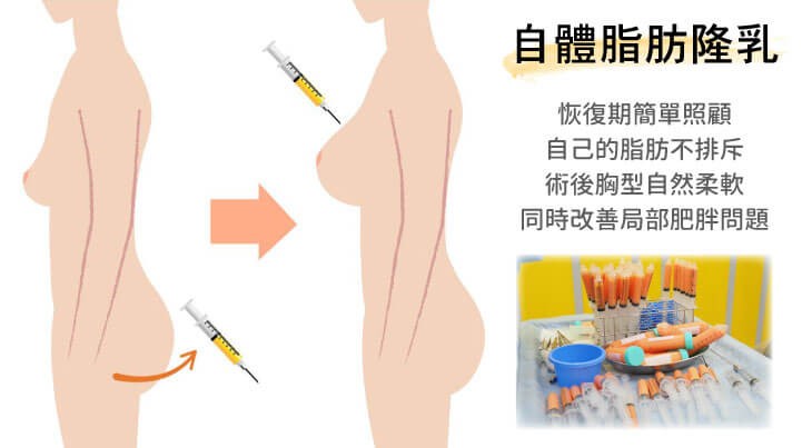 自體脂肪移植原理