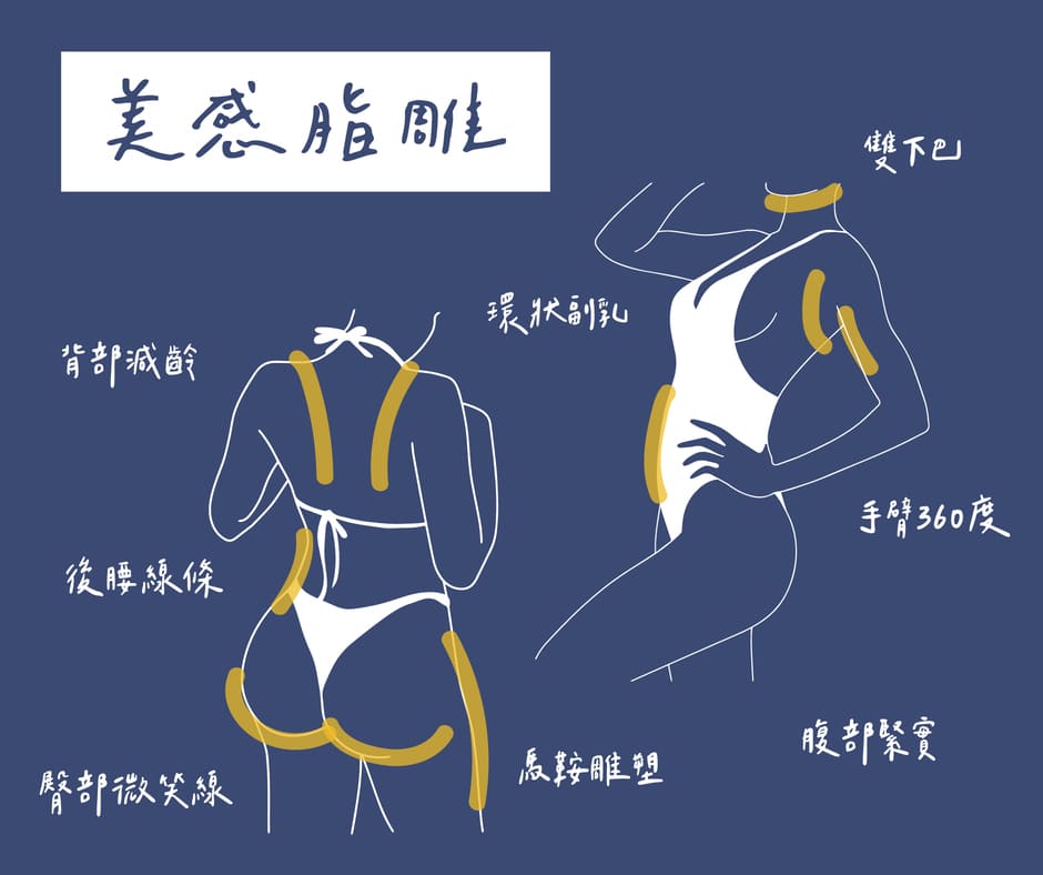liposuction-basics 常見抽脂部位