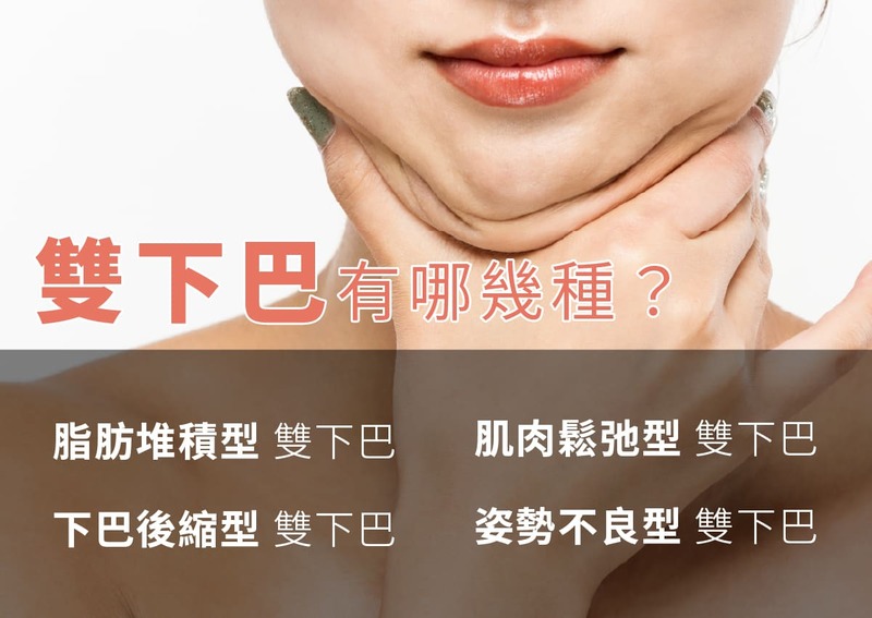 double-chin-surgery-9 double-chin-surgery-9