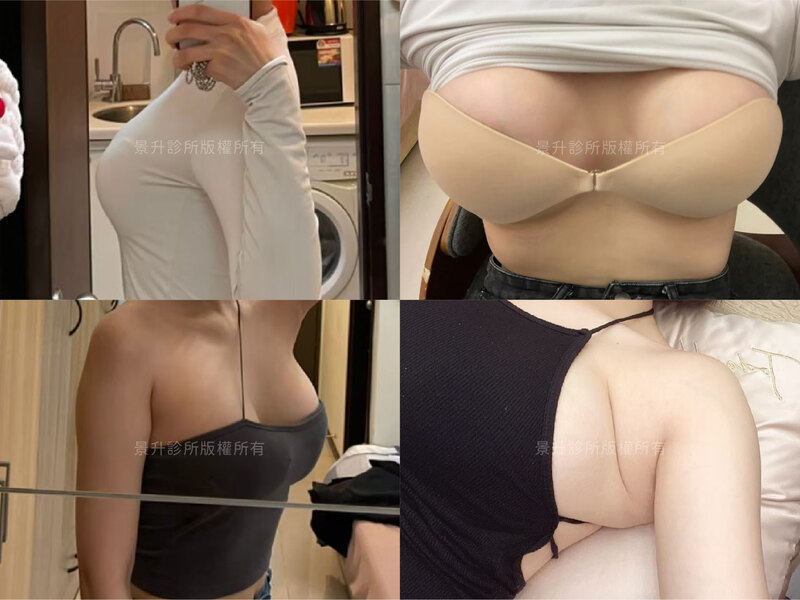 hana-case-2 hana-case-2