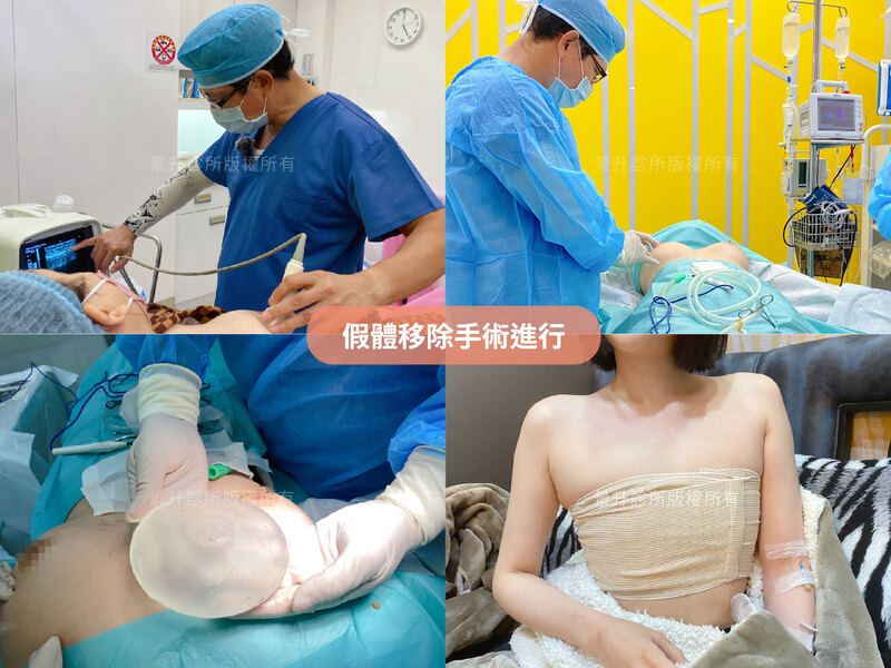 hana-case-4 hana-case-4