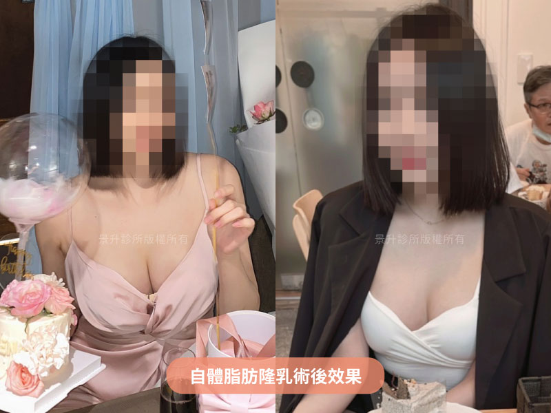 hana-case-8 hana-case-8