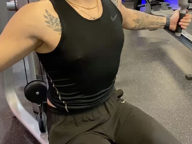 jackson-gynecomastia-caes-9