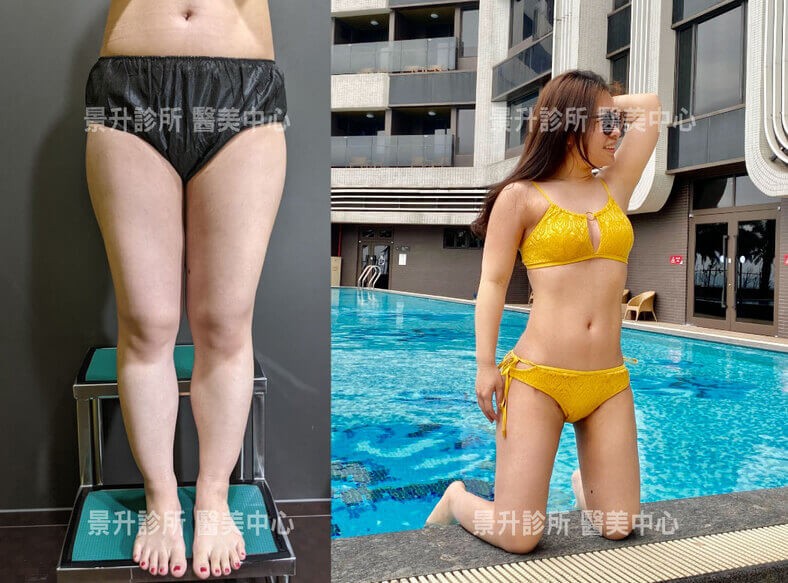 mandy-case-show mandy-case-show