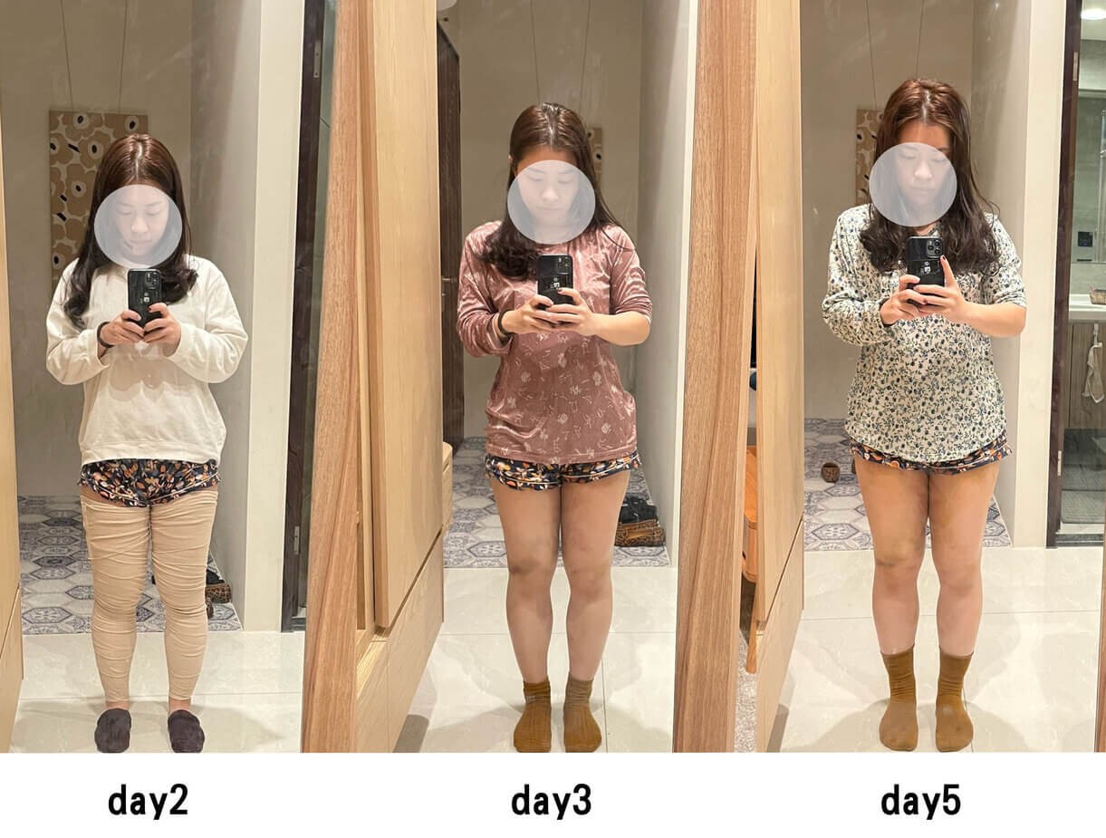 mandy-liposuction-recovery-recording-1 mandy-liposuction-recovery-recording-1