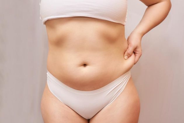 多囊性卵巢症候群引起的肥胖怎麼改善?